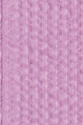 Advantage Plus Patient Bib 3 Ply Tiss/Poly 13 in x 18 in Bge Disposable 500/Ca thumbnail 5