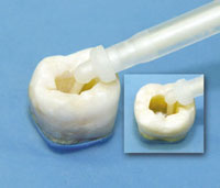 Flexi-Flow Root Canal Automix Intraoral Tips, Brown, 20/Pk, 870-20 image