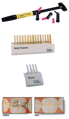 -TETRIC EVOCERAM CAVIFIL ASST 0.2G (40) product image