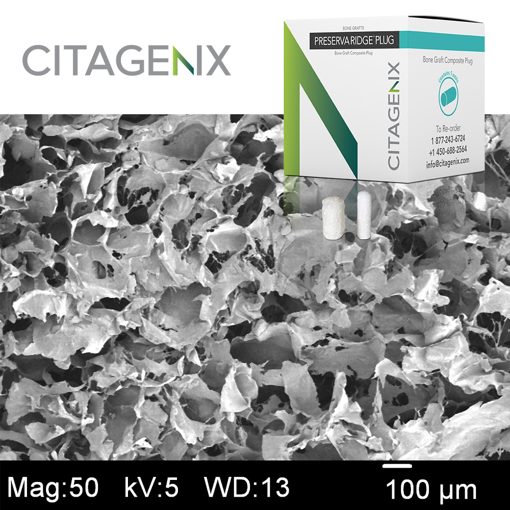 525-4071  PreservaRidge Plug, 6x25 mm, 5/Box, PRPSLM product image