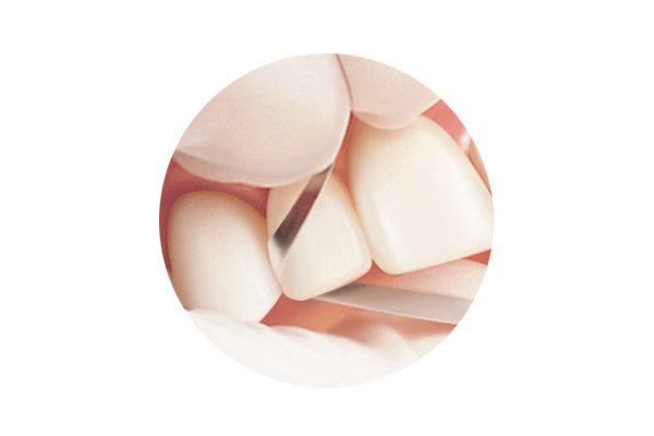 Compo-Strip 200T2 for Orthodontic Reproximation, Double-Sided, 4 mm, 3/Pk, 2013180 thumbnail 13