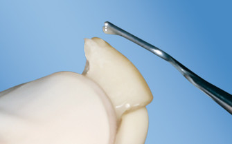 LuxaFlow Provisional Add-On Material, Syringe Refill, 1.5 g, A3, 2/Pk, 224003 thumbnail 14