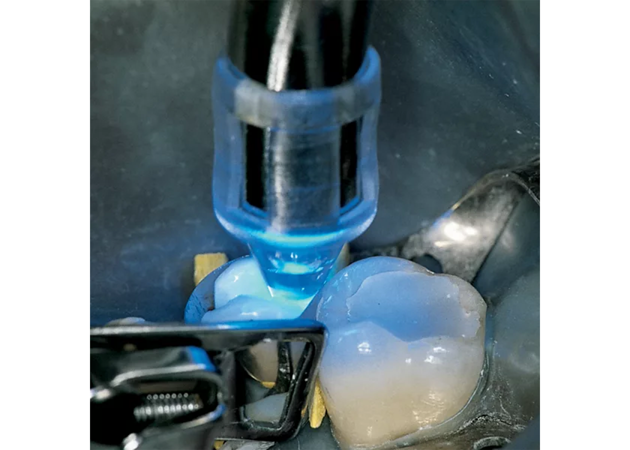 Focu-Tip Curing Light Tip 9.5 mm White 2/Pk thumbnail 4