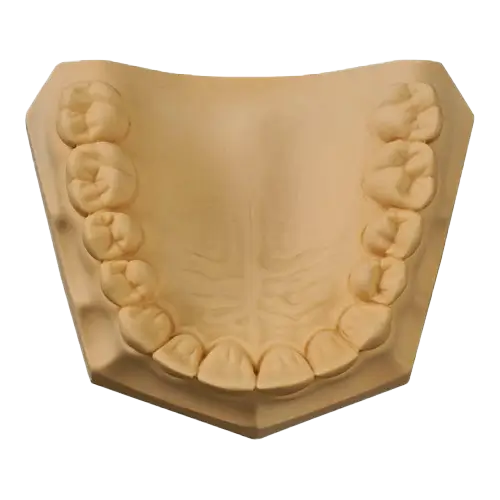 UltiRock Die Stone ISO Type 4 Golden Brown 33Lb/Bx image