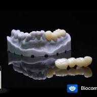 Splint 3D Print Resin Ea thumbnail 4