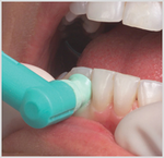 Pivot Prophy Angle Soft 144/Bx thumbnail 7