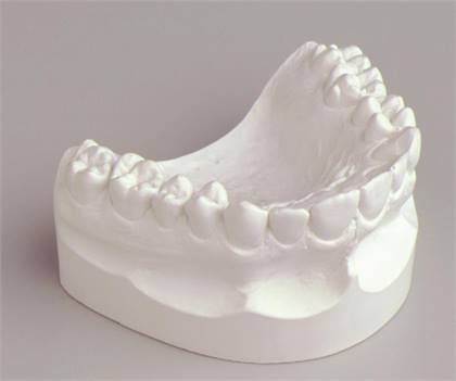 Snow White Lab Plaster #2 33lbs Rapid thumbnail 11