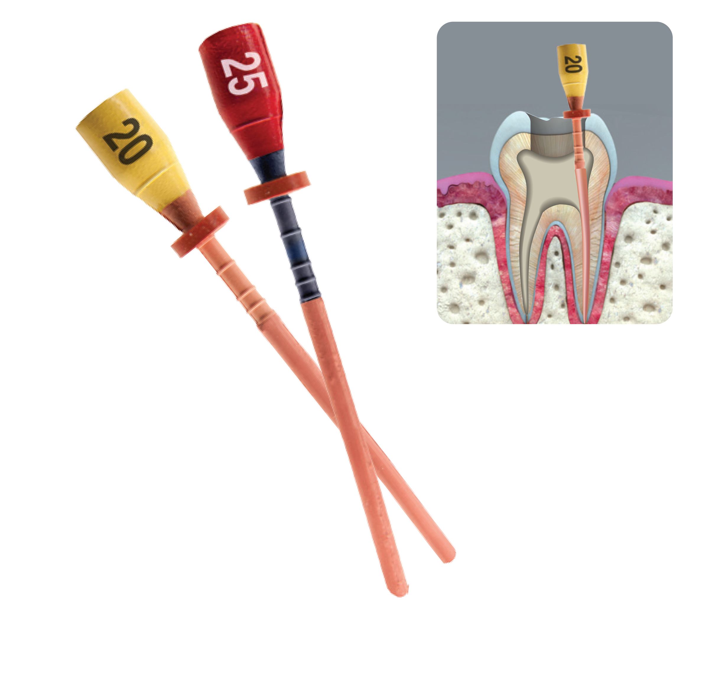 One File G Thermal Obturators, Plastic Carriers, # 35, Medium, Green, 5/Pk, OOP-35 thumbnail 3