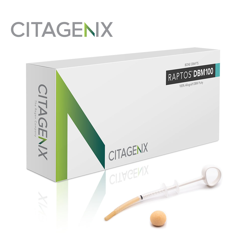 Raptos DBM100 Putty, 0.5cc, 1 syringe/Box, RDBM100-P05 thumbnail 2