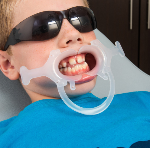 Practicon C-Type Winged Cheek Retractor Small (10) product image