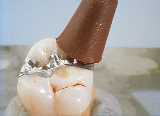 Brownie Polishers, Pre-Polishing, FG, Mini-Point, # 030, Brown, 12/Pk, 0413 thumbnail 16