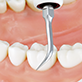 Varios Tip Ultrasonic Scaler G8 Ea thumbnail 3