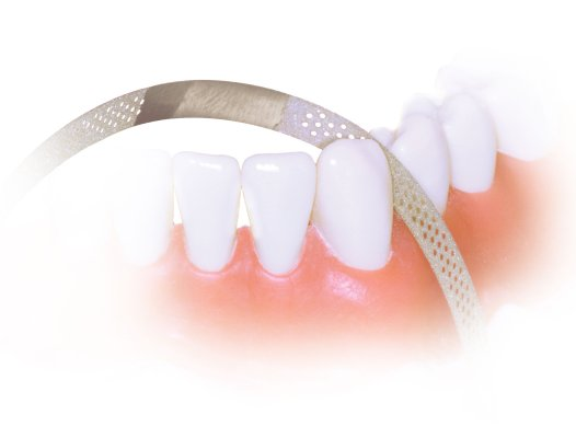 Axis - Perforated Diamond Finishing Strip Super Fine 4.0mm 10/Pk thumbnail 15