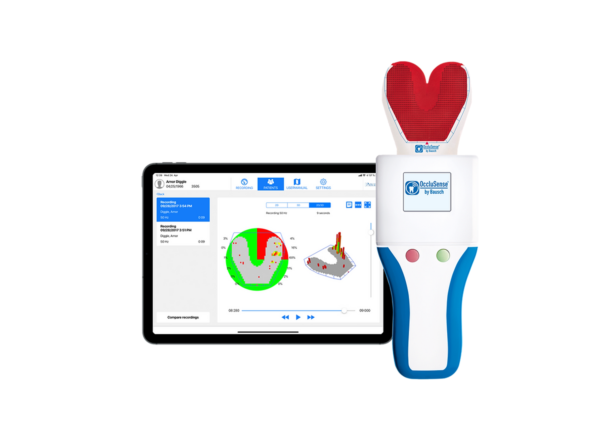 OccluSense Pressure Sensor Digital Refill 25/Bx thumbnail 4
