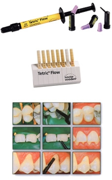 IPS Empress Direct Opaque Composite, Light-Cure, Syringe Refill, 1.8 g, Universal Viscosity, Opaque, 1/Pk, 637897 thumbnail 3