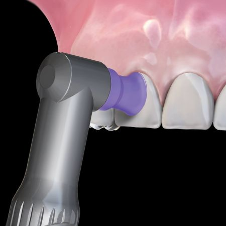 Hu-Friedy Prophy Angle Firm Spiral Straight Latex-Free 100/Bx thumbnail 8