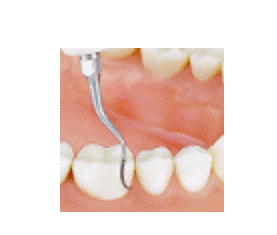 P3D Varios Scaler Perio Tip Left Curved thumbnail 3